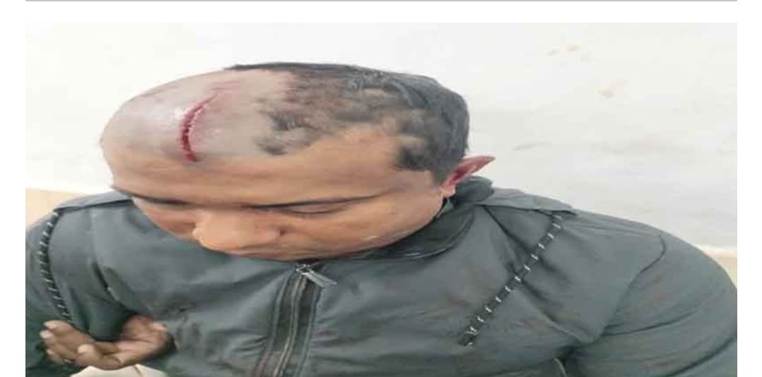 টাঙ্গাইলের মির্জাপুরে স্কয়ার ফার্মাসিউটিক্যাল কোম্পানীর সিনিয়র সেলস্ মেডিকেল অফিসার গুল রায়হানকে (৩৮) কুপিয়ে গুরুতর আহত করা হয়েছে। আহত অবস্থায় উদ্ধার করে তাকে টাঙ্গাইল সদর হাসপাতালে ভর্তি করা হয়েছে।
