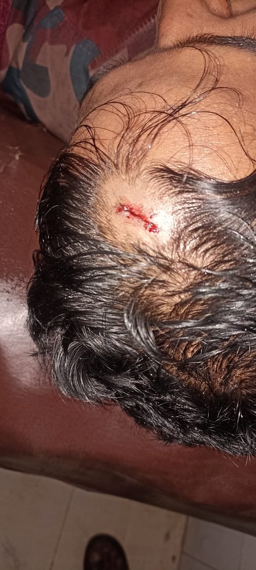 জৈন্তাপুরে চোরাকারবারিদের হামলায় রক্তাক্ত বিজিবি, গরু ছিনতাই
